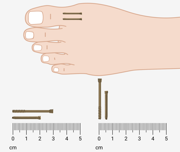 Non-Surgical Treatments